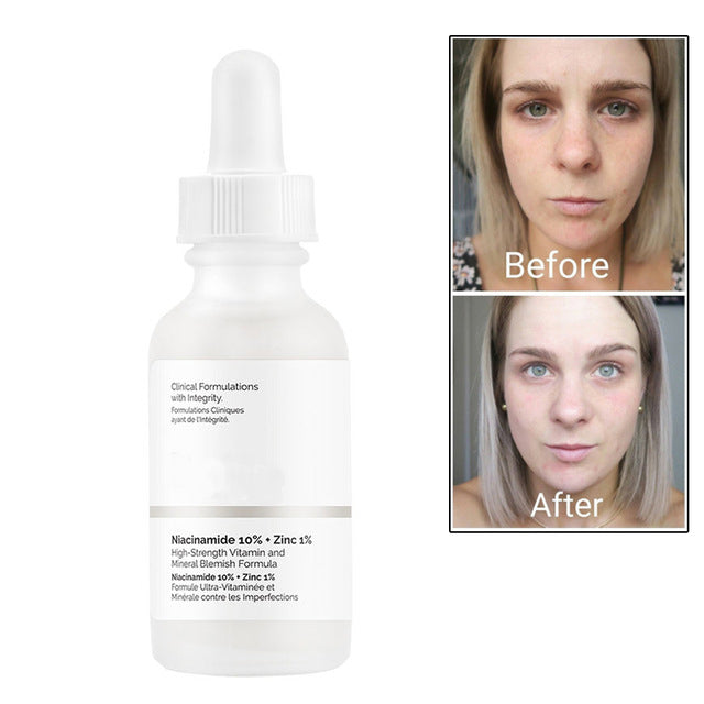 peeling solution AHA 30%+ BHA 2% hyaluronic acid