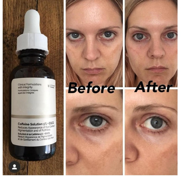 peeling solution AHA 30%+ BHA 2% hyaluronic acid